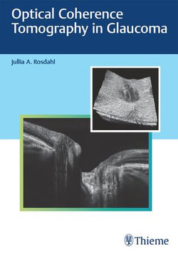 Optical Coherence Tomography in Glaucoma