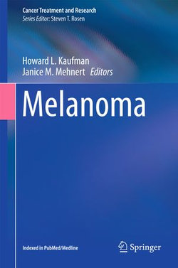 Melanoma