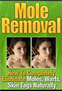 Mole Removal