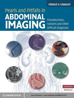 Pearls and Pitfalls in Abdominal Imaging