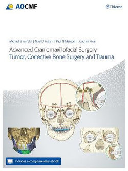 Advanced Craniomaxillofacial Surgery