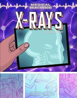 X-Rays