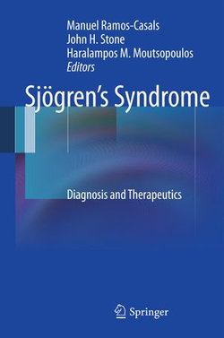 Sjögren’s Syndrome