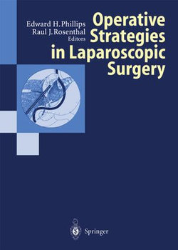 Operative Strategies in Laparoscopic Surgery