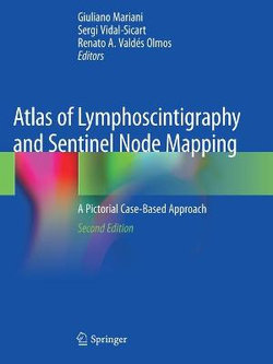 Atlas of Lymphoscintigraphy and Sentinel Node Mapping