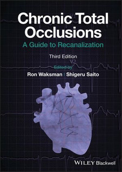 Chronic Total Occlusions