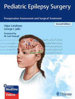 Pediatric Epilepsy Surgery