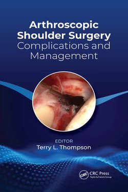 Arthroscopic Shoulder Surgery