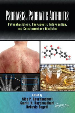 Psoriasis and Psoriatic Arthritis