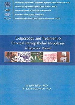 Colposcopy and Treatment of Cervical Intraepithelial Neoplasia