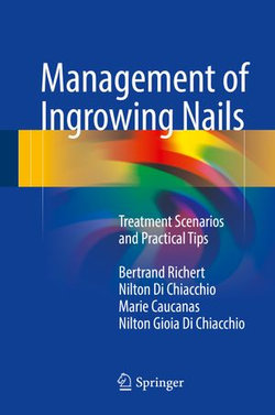 Management of Ingrowing Nails