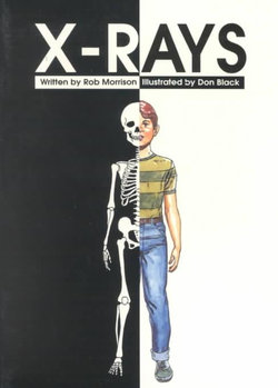 X-Rays