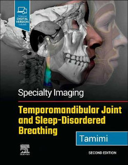 Specialty Imaging: Temporomandibular Joint and Sleep-Disordered Breathing