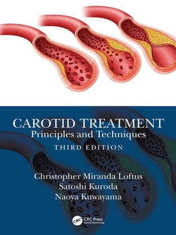 Carotid Treatment: Principles and Techniques