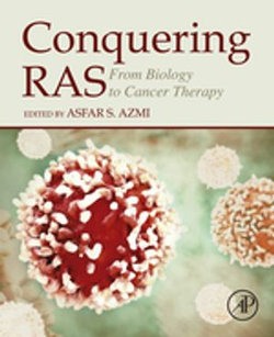 Conquering RAS