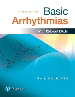 Basic Arrhythmias with 12-Lead EKGs