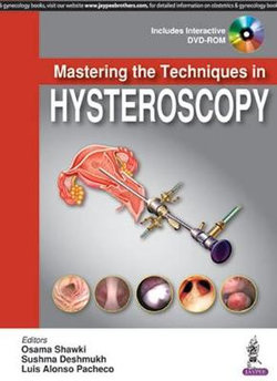 Mastering the Techniques in Hysteroscopy