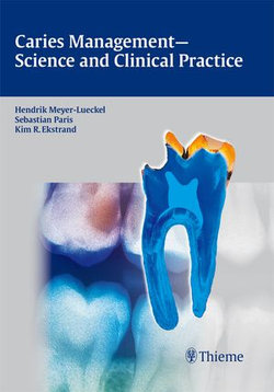 Caries Management - Science and Clinical Practice