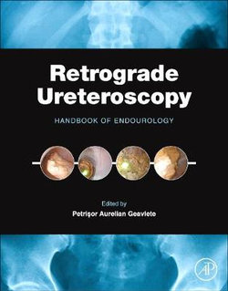 Retrograde Ureteroscopy