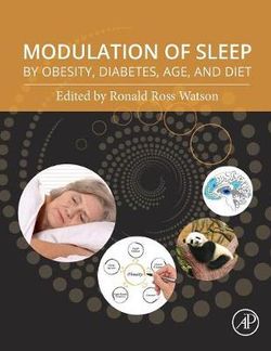 Modulation of Sleep by Obesity, Diabetes, Age, and Diet