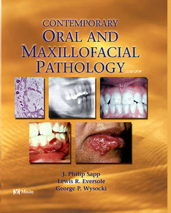 Contemporary Oral and Maxillofacial Pathology