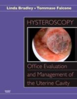 Hysteroscopy