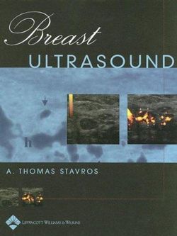 Breast Ultrasound