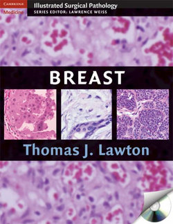 Breast