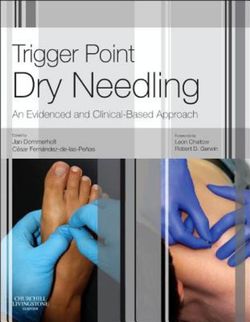 Trigger Point Dry Needling