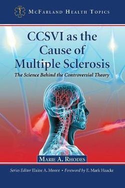 CCSVI as the Cause of Multiple Sclerosis