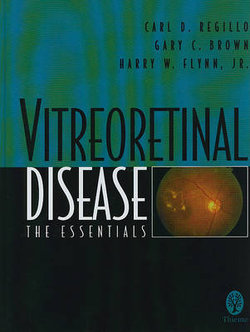 Vitreoretinal Disease