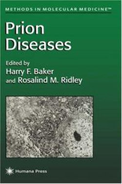 Prion Diseases