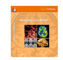 Imaging of the Brain