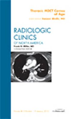 Thoracic Multidetector CT Comes of Age, An Issue of Radiologic Clinics of North America: Volume 48-1