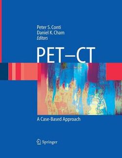 PET-CT