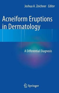 Acneiform Eruptions in Dermatology