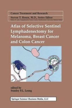 Atlas of Selective Sentinel Lymphadenectomy for Melanoma, Breast Cancer and Colon Cancer