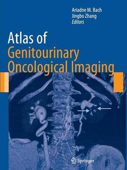 Atlas of Genitourinary Oncological Imaging