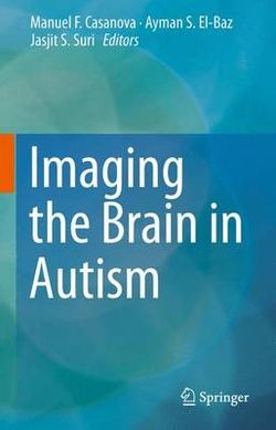 Imaging the Brain in Autism