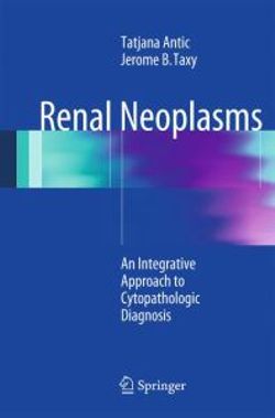 Renal Neoplasms