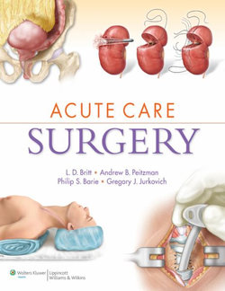 Acute Care Surgery