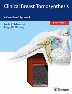 Clinical Breast Tomosynthesis