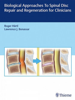 Biological Approaches to Spinal Disc Repair and Regeneration for Clinicians