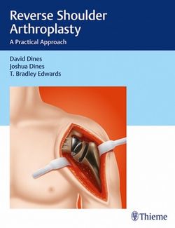 Reverse Shoulder Arthroplasty