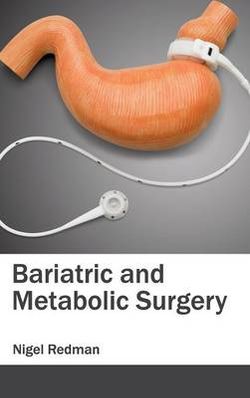 Bariatric and Metabolic Surgery