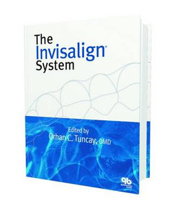 The Invisalign System