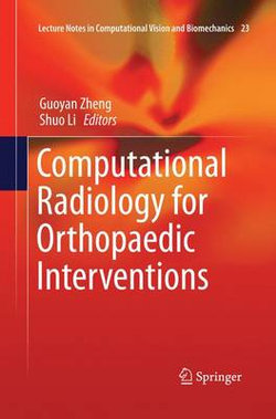 Computational Radiology for Orthopaedic Interventions