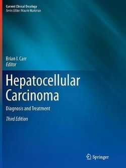 Hepatocellular Carcinoma