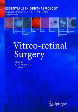 Vitreo-retinal Surgery