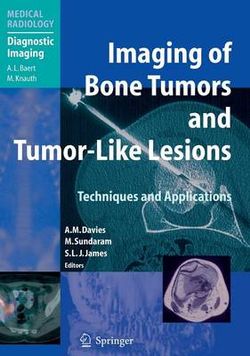 Imaging of Bone Tumors and Tumor-Like Lesions